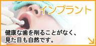 インプラント